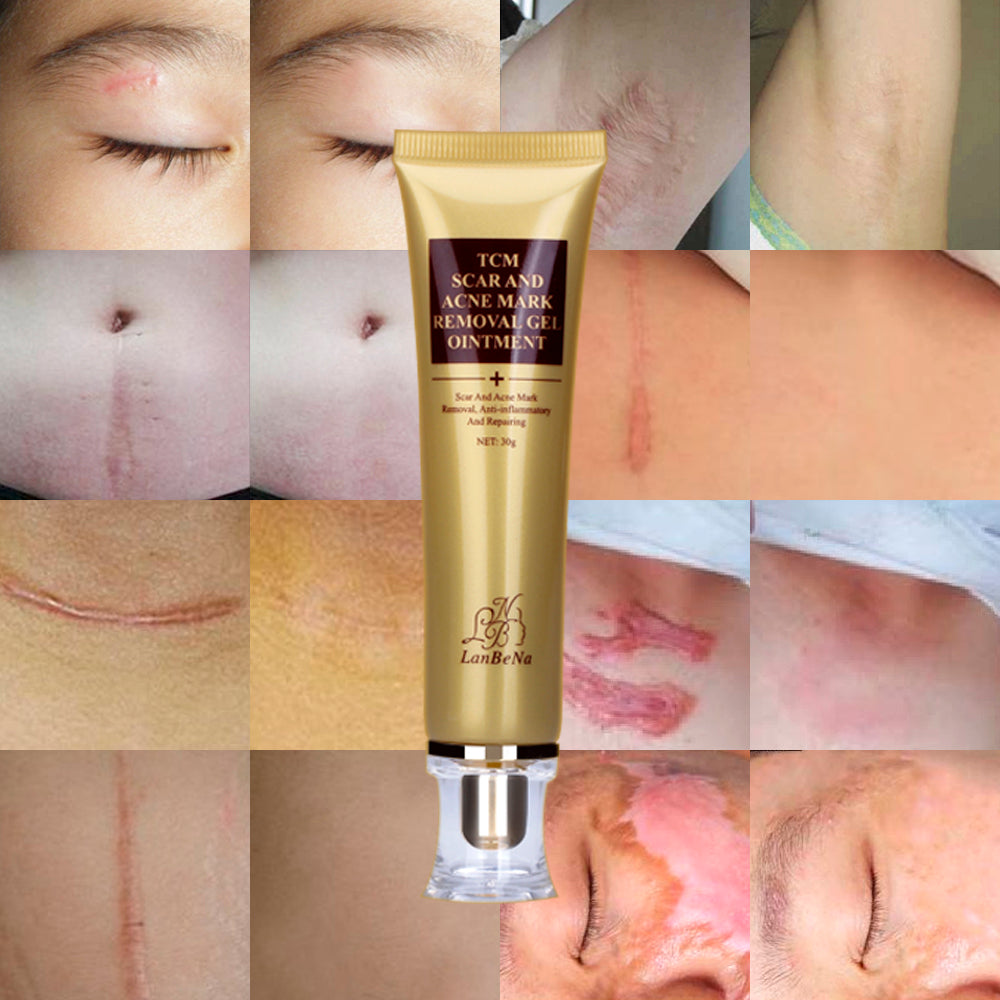 Acne Scar Removal Cream